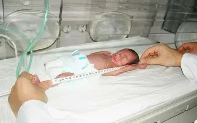 Parmak Çocuğa 'Gül' İsmi Verildi