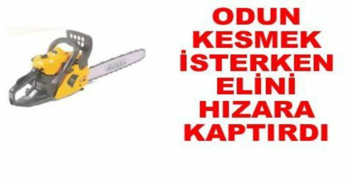 Elini Hızar Makinesine Kaptırdı