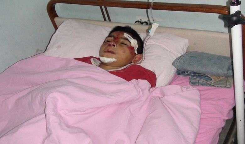 Bindikleri Bisiklet Devrildi: 3 Yaralı - Samsun'un Alaçam ilçesi Etyemez köyünde aynı bisiklette binen 2'si çocuk 3 kişi, bisikletin devrilmesi sonucu yaralandı. Yaralılardan birinin durumunun ağır olduğu ifade edildi.