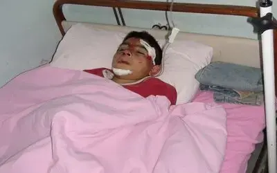 Bindikleri Bisiklet Devrildi: 3 Yaralı