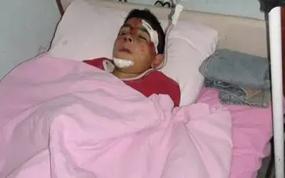 Bindikleri Bisiklet Devrildi 3 Yaralı