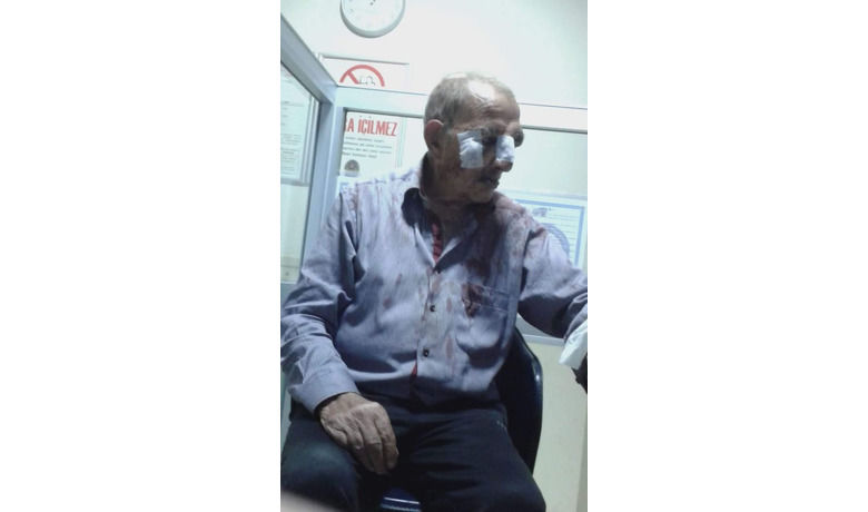 Huzurevinde Huzursuzluk: Oda Arkadaşını Darp Etti  - Samsun'un Bafra ilçesi 75. Yıl Huzurevinde iki erkek şahıs arasındaki tartışmada bir huzurevi sakini darp edildi