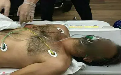 Havaya ateş ederken kendini ağır yaraladı
