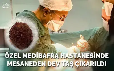 Özel Medibafra Hastanesinde Mesaneden Dev Taş Çıkarıldı