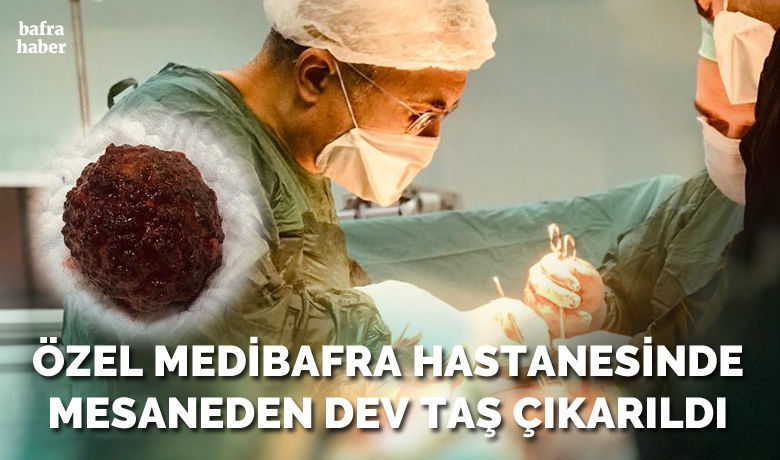 Özel Medibafra Hastanesinde Mesaneden Dev Taş Çıkarıldı