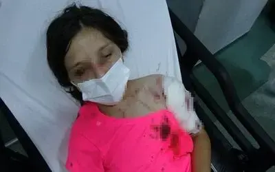 Kız çocuğuna dehşeti yaşatan pitbullun sahibine ceza yağacak
