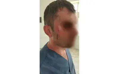 Sağlık çalışanına şiddet: 1 yaralı
