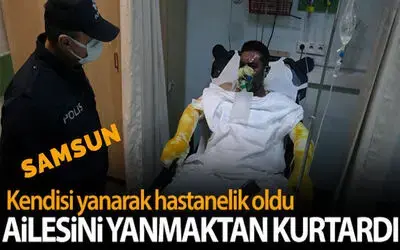 Yangında ailesini yanmaktan kurtardı, kendisi yanarak hastanelik oldu