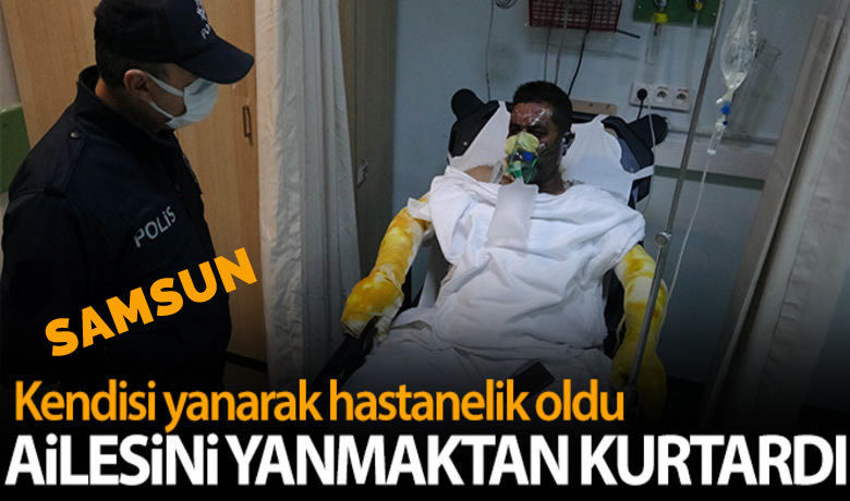 Yangında ailesini yanmaktan kurtardı,kendisi yanarak hastanelik oldu