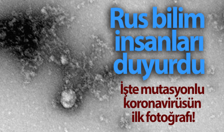 Rusya'da, korona virüsmutasyonunun fotoğrafı çekildi - Rusya’da, İngiltere’de ortaya çıkan yeni korona virüs mutasyonunun ilk mikroskobik fotoğrafı çekildi.