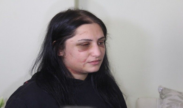 Eski eşini darpeden zanlının iddianamesi tamamlandı - Samsun’da eski eşini öldüresiye darp eden zanlının iddianamesi tamamlandı. Zanlı için 18 yıla kadar hapis istendi.