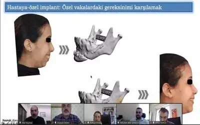 Prof. Dr. Kaymaz: “Hastanelerde ‘hastaya özel’ implant tasarımı ve imalat birimleri kurulmalı”
