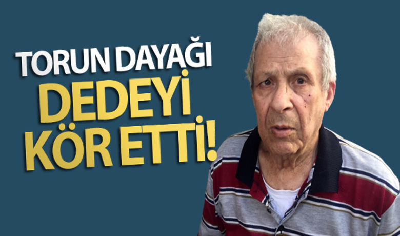 Torun dayağı dedeyi kör etti - Adana’da bir kişi para vermediği için dövdüğü 81 yaşındaki dedesini kör olmasına neden oldu.