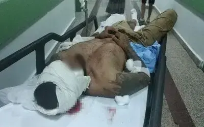 Bıçaklı saldırıda yaralandı
