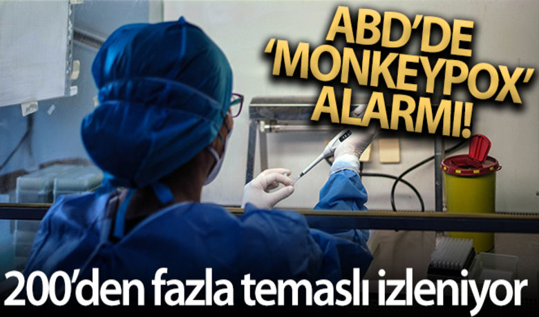 ABD'de Monkeypox virüsü alarmı:200'den fazla temaslı izleniyor - ABD Hastalık Kontrol ve Önleme Merkezleri (CDC), 27 eyalette 200'den fazla kişinin olası nadir maymun çiçeği virüsü (Monkeypox) nedeniyle izlendiğini bildirdi.