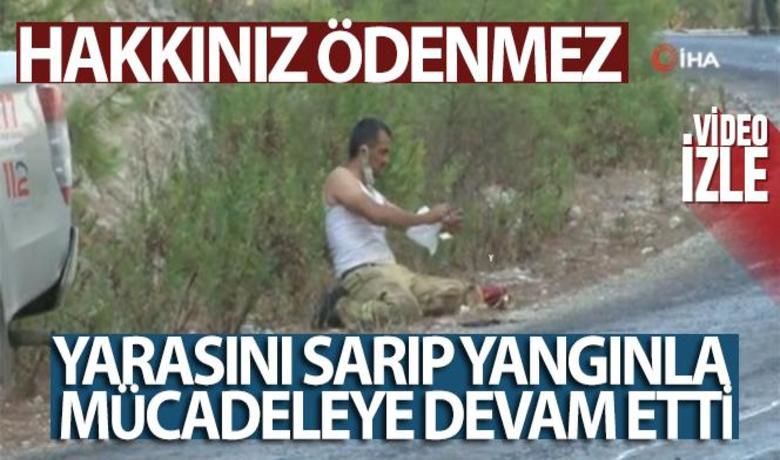 Orman işçisi yarasını sarıp,yangınla mücadeleye devam etti - Antalya'nın Manavgat ilçesindeki yangın dağlık kısımdaki ormanlık alanın farklı noktalarında devam ediyor.	Vücudunda yanıklar oluştu, ilk yardımını kendi yaptı