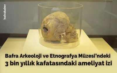 3 bin yıllık kafatasında ameliyat izi