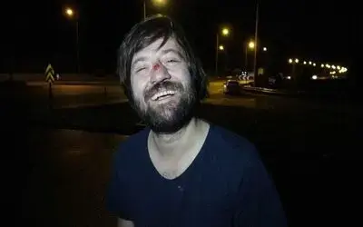 Sinema sanatçısı Sadi Celil Cengiz kazada yaralandı
