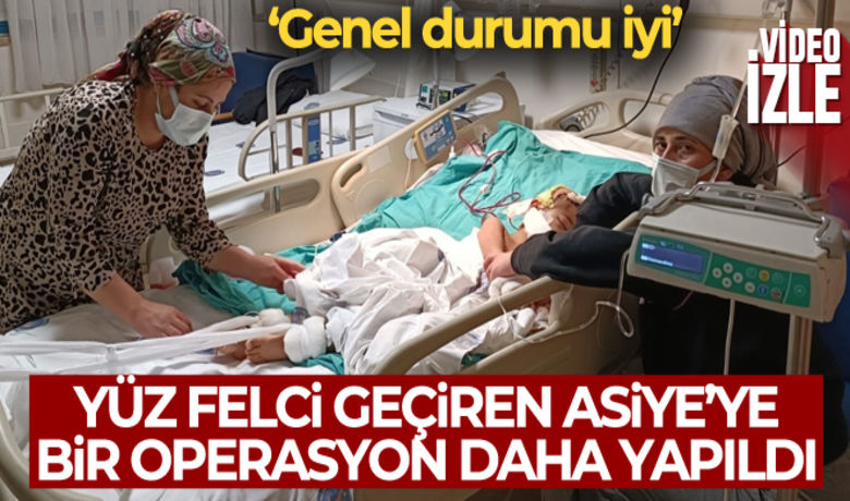 Pitbull saldırısında yaralananAsiye'ye bir operasyon daha - Gaziantep'te pitbull cinsi iki köpeğin saldırısında ağır yaralanan ve Antalya Akdeniz Üniversitesi Hastanesi'nde doku nakli yapılan 4 yaşındaki Asiye Ateş’e kulaktaki hasarına ve yüz felcine yönelik yeni operasyonlar yapıldı.