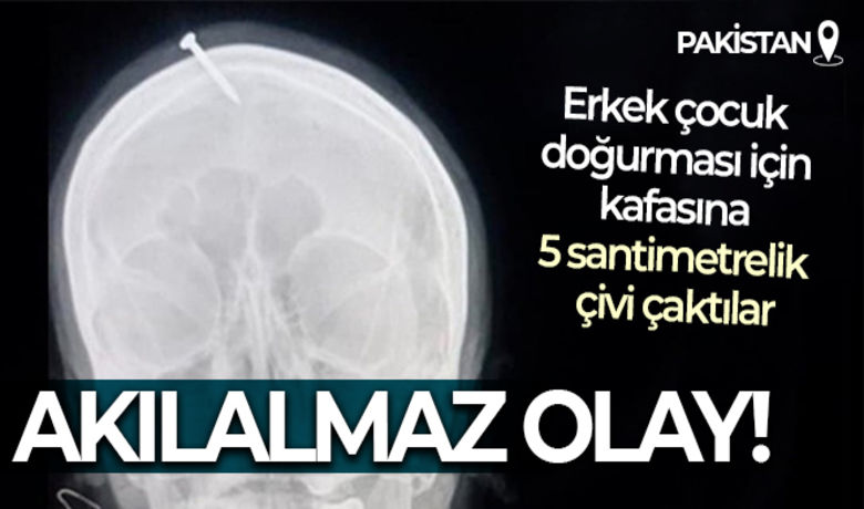 Pakistan'da erkek çocuk doğurmak için hamile kadının kafasına 5