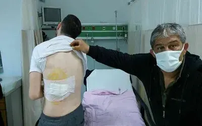Ankara’dan bayram için geldiği Samsun’da sokak köpeğinin saldırısına uğradı

