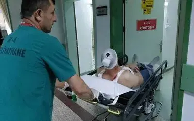 Samsun’da silahlı saldırıya uğrayan kardeşler yaralandı
