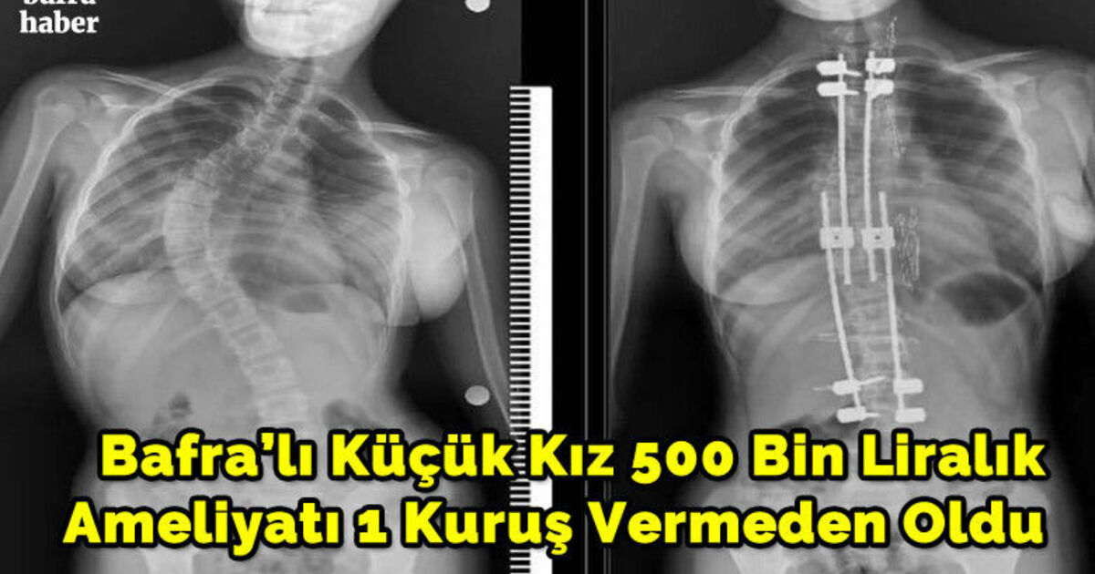 500 bin liralık ameliyatı 1 kuruş vermeden oldu