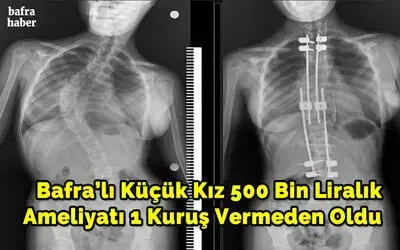 500 bin liralık ameliyatı 1 kuruş vermeden oldu