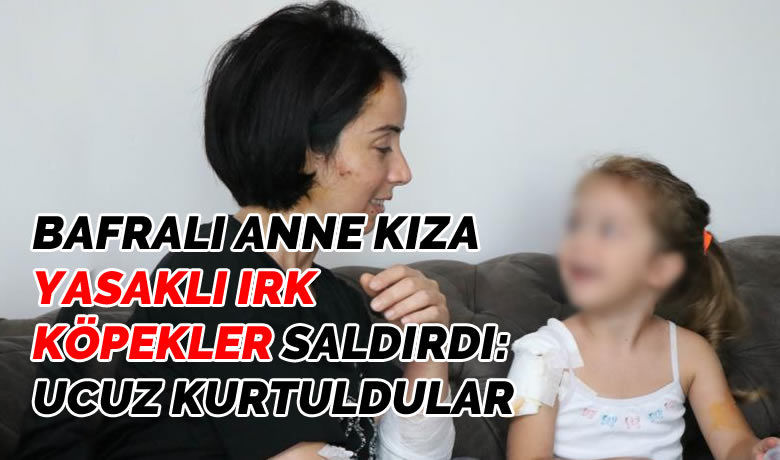 Bafralı anne kıza yasaklı ırk köpekler saldırdı