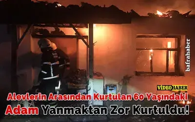 Alevlerin Arasından Kurtulan 60 Yaşındaki Adam Yanmaktan Zor Kurtuldu