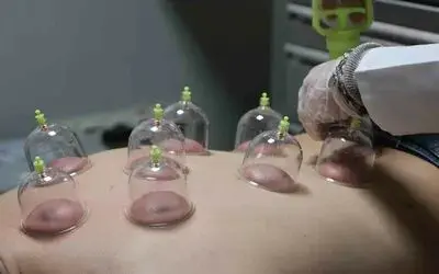 Uzmanından merdiven altı ’sülük’ ve ’hacamat’ uyarısı
