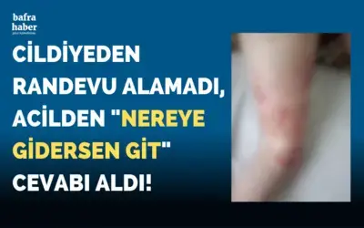 Cildiyeden Randevu Alamadı, Acilde Nereye Gidersen Git Cevabı Aldı!