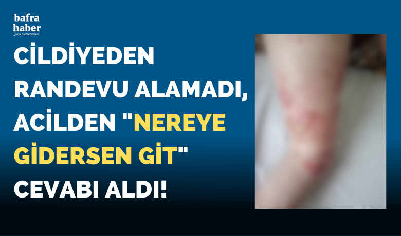 Cildiyeden Randevu Alamadı, Acilde Nereye Gidersen Git Cevabı Aldı!
