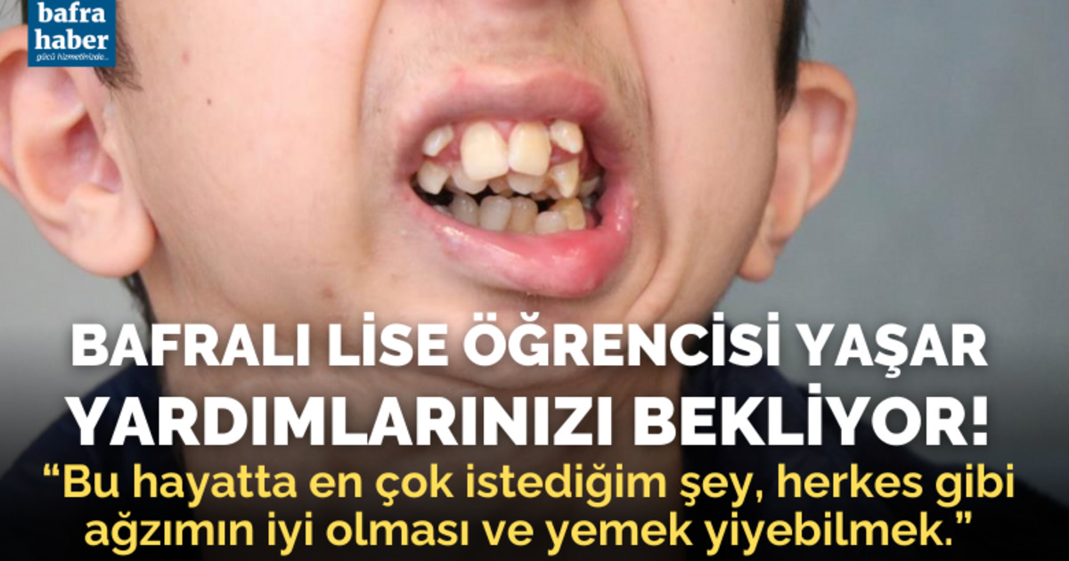 Alt çenesi yok, dişleri üst damağında: Ameliyat için yardım bekliyor