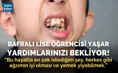 Alt çenesi yok, dişleri üst damağında: Ameliyat için yardım bekliyor