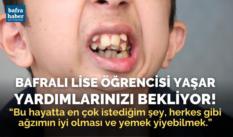 Alt çenesi yok, dişleri üstdamağında: Ameliyat için yardım bekliyor