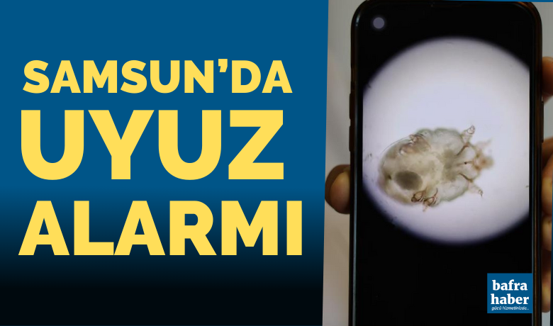 Samsun’da uyuz alarmı