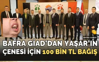 Bafra Giad’dan Yaşar’ın Çenesi İçin 100 Bin Tl Bağış