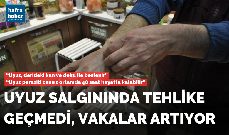 Uyuz salgınında tehlike geçmedi, vakalar artıyor - Dermatoloji Uzmanı Asiye Yıldız, uyuz vakalarındaki artışın devam ettiğini ifade ederek, poliklinik hastalarının yüzde 30’unun bu vakaların oluşturduğunu söyledi.