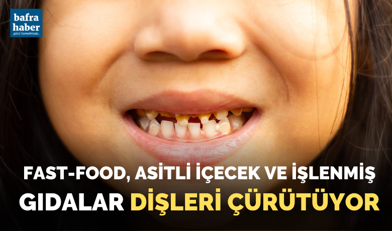 Fast-food, asitli içecek ve işlenmiş gıdalar dişleri çürütüyor