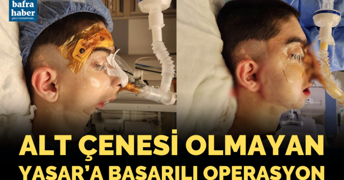 Alt çenesi olmayan Yaşar'a başarılı operasyon