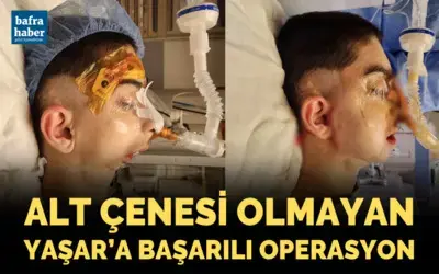 Alt çenesi olmayan Yaşar'a başarılı operasyon