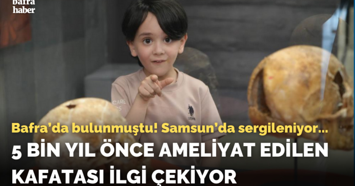 5 bin yıl önce ameliyat edilen kafatası ilgi çekiyor