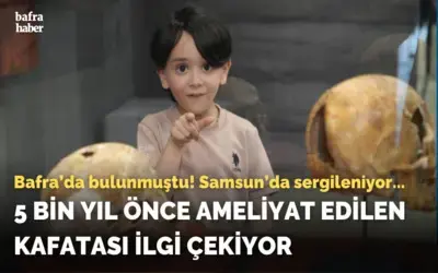 5 bin yıl önce ameliyat edilen kafatası ilgi çekiyor