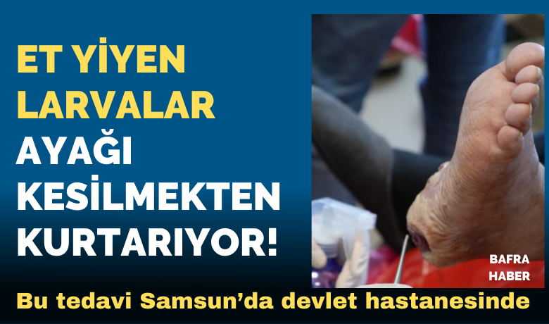 Et yiyen larvalar ayağı kesilmekten kurtuluyor