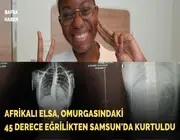 Afrikalı Elsa, omurgasındaki 45 derece eğrilikten Samsun’da kurtuldu