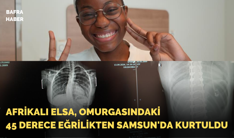 Afrikalı Elsa, omurgasındaki 45derece eğrilikten Samsun’da kurtuldu