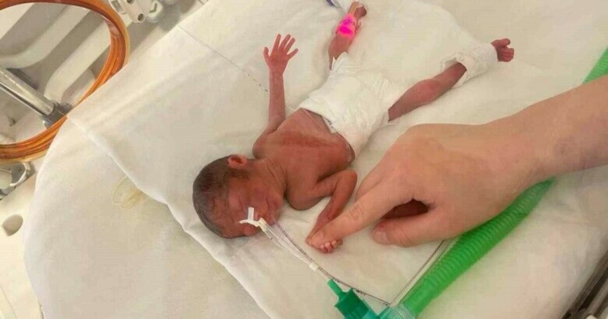 400 gram doğan Aylin bebek hayata tutundu