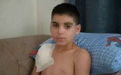 Vücudu köpek tarafından parçalanan Yunus’un kolu kullanılamaz hale geldi, aile adalet arıyor
